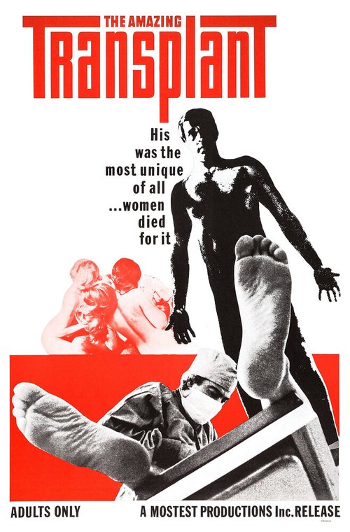 The Amazing Transplant (1970) смотреть онлайн