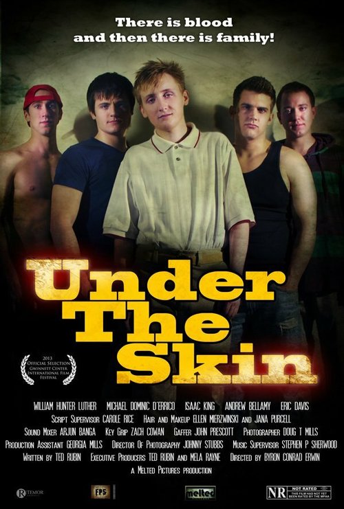 Under the Skin